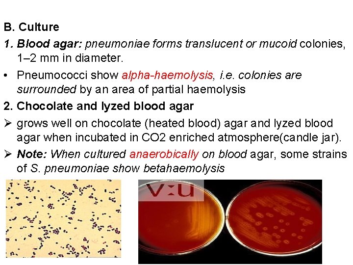B. Culture 1. Blood agar: pneumoniae forms translucent or mucoid colonies, 1– 2 mm