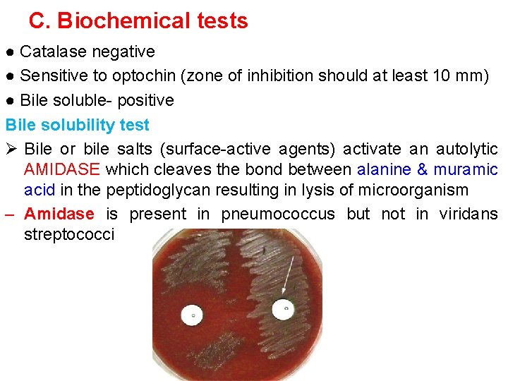 C. Biochemical tests ● Catalase negative ● Sensitive to optochin (zone of inhibition should