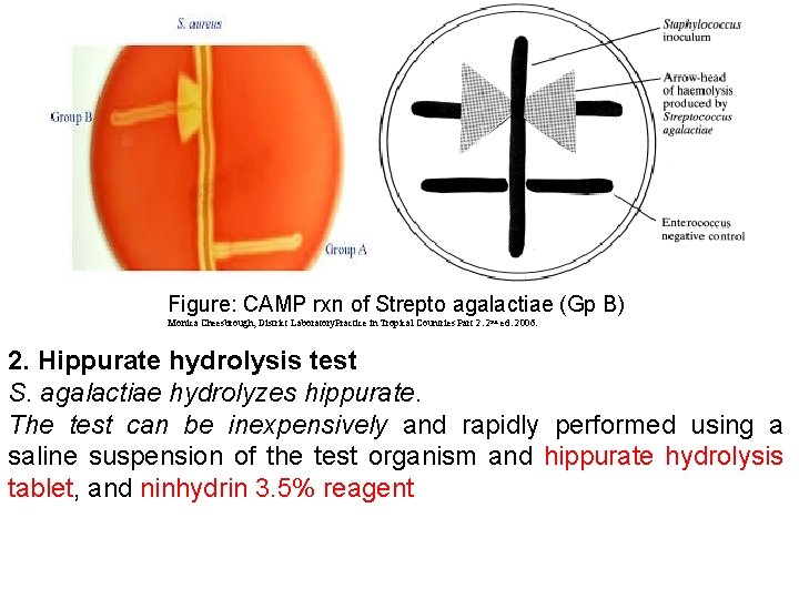 Figure: CAMP rxn of Strepto agalactiae (Gp B) Monica Cheesbrough, District Laboratory. Practice in