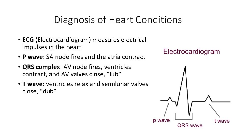 Diagnosis of Heart Conditions • ECG (Electrocardiogram) measures electrical impulses in the heart • Diagnosis of Heart Conditions • ECG (Electrocardiogram) measures electrical impulses in the heart •