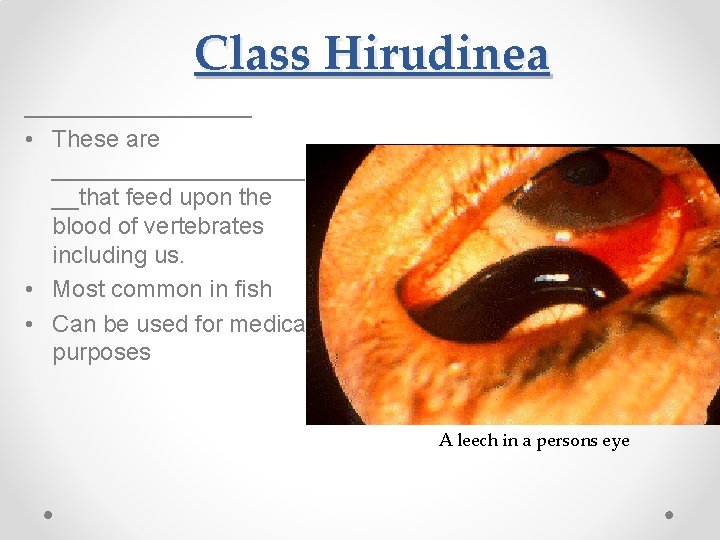 Class Hirudinea _________ • These are __________ __that feed upon the blood of vertebrates