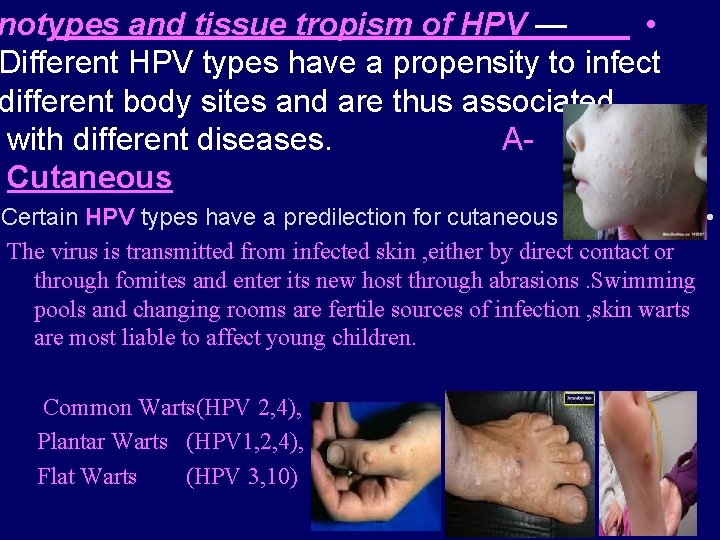 notypes and tissue tropism of HPV — • Different HPV types have a propensity