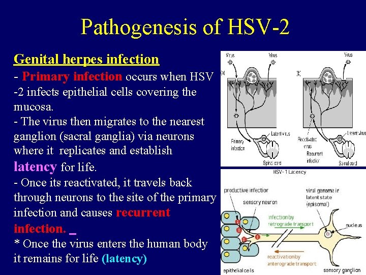 Pathogenesis of HSV-2 Genital herpes infection - Primary infection occurs when HSV -2 infects