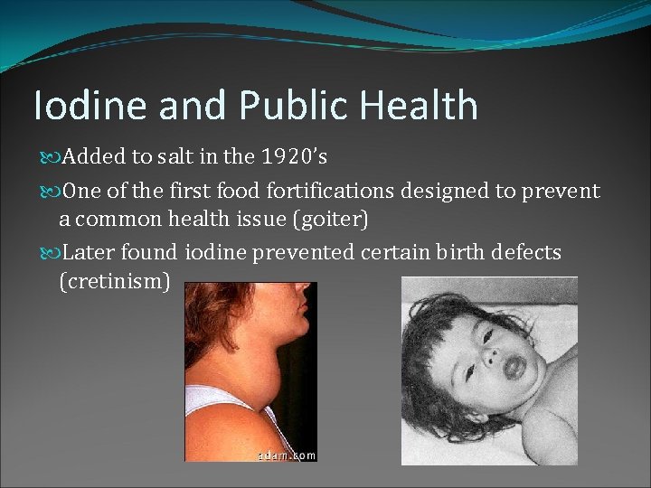 Iodine and Public Health Added to salt in the 1920’s One of the first