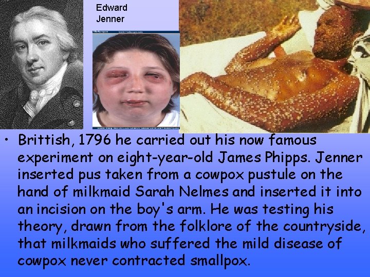 Edward Jenner • Brittish, 1796 he carried out his now famous experiment on eight-year-old