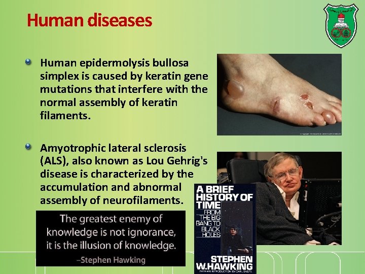 Human diseases Human epidermolysis bullosa simplex is caused by keratin gene mutations that interfere