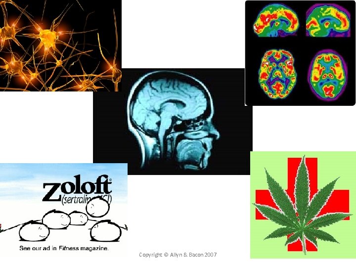 Copyright © Allyn & Bacon 2007 