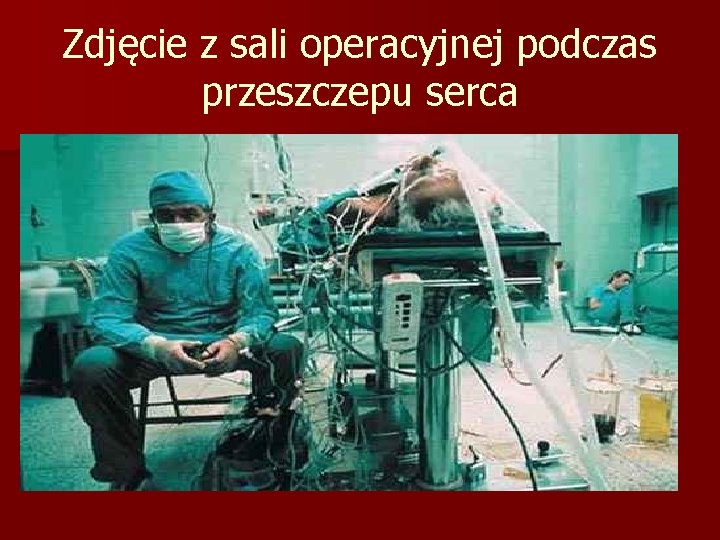 Zdjęcie z sali operacyjnej podczas przeszczepu serca 