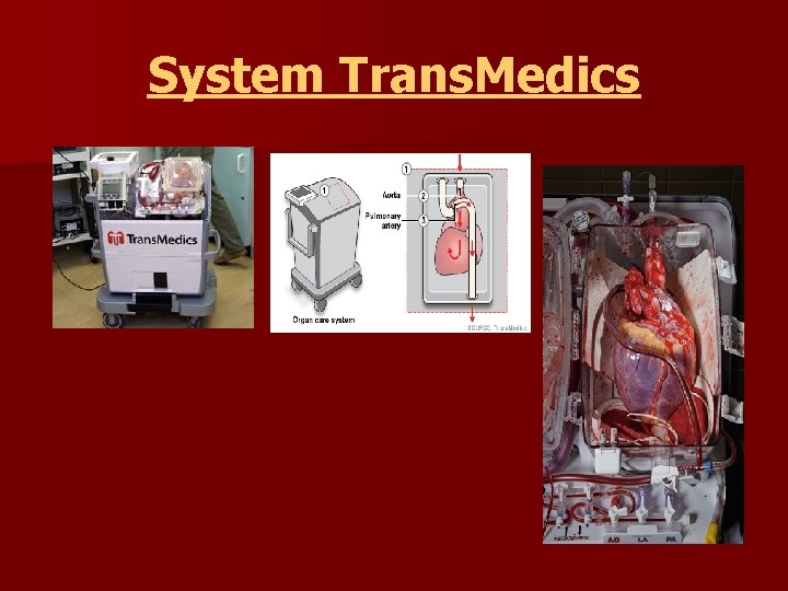 System Trans. Medics 