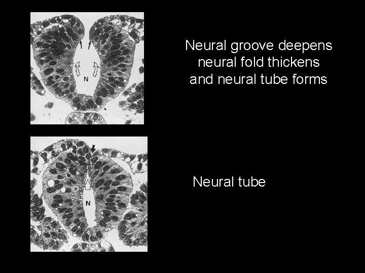 Neural groove deepens neural fold thickens and neural tube forms Neural tube 