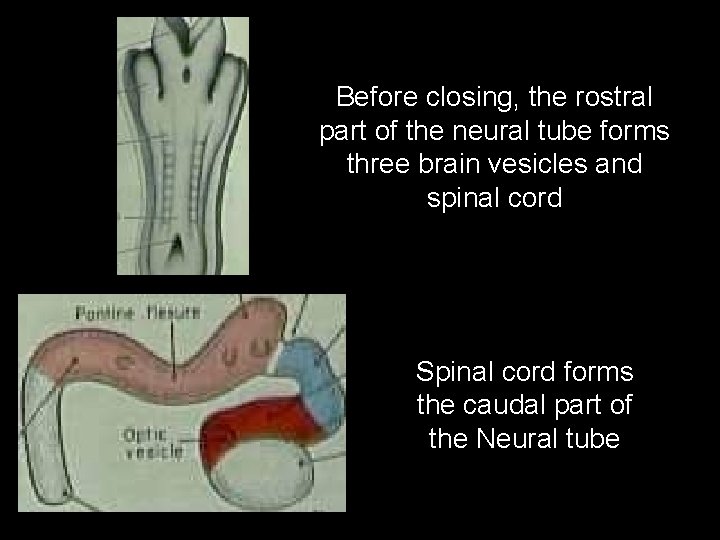 Before closing, the rostral part of the neural tube forms three brain vesicles and