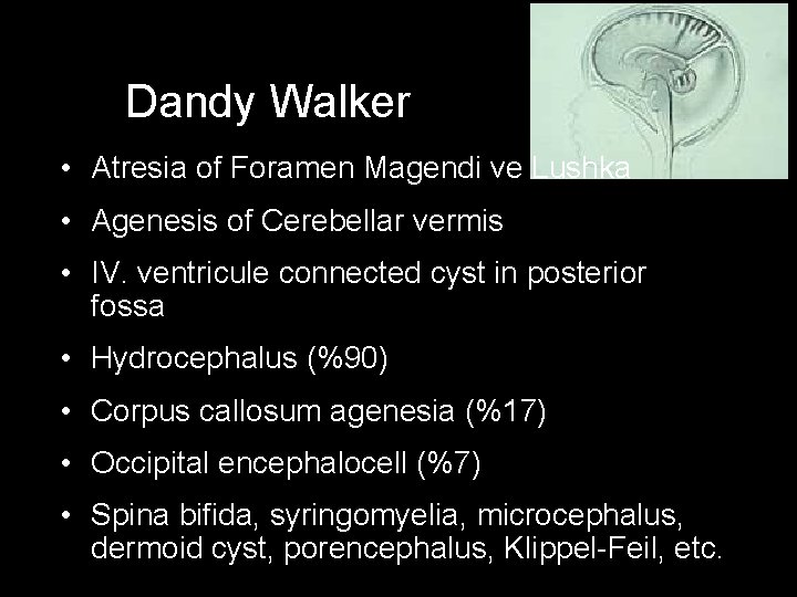 Dandy Walker • Atresia of Foramen Magendi ve Lushka • Agenesis of Cerebellar vermis