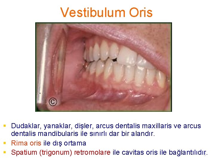 Vestibulum Oris § Dudaklar, yanaklar, dişler, arcus dentalis maxillaris ve arcus dentalis mandibularis ile