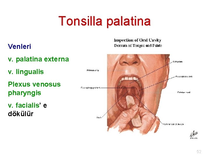 Tonsilla palatina Venleri v. palatina externa v. lingualis Plexus venosus pharyngis v. facialis’ e