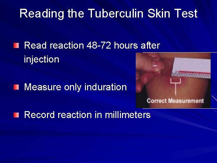 Reading the Tuberculin Skin Test Read reaction 48 -72 hours after injection Measure only