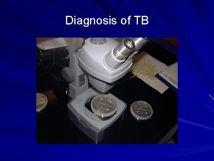 Diagnosis of TB 