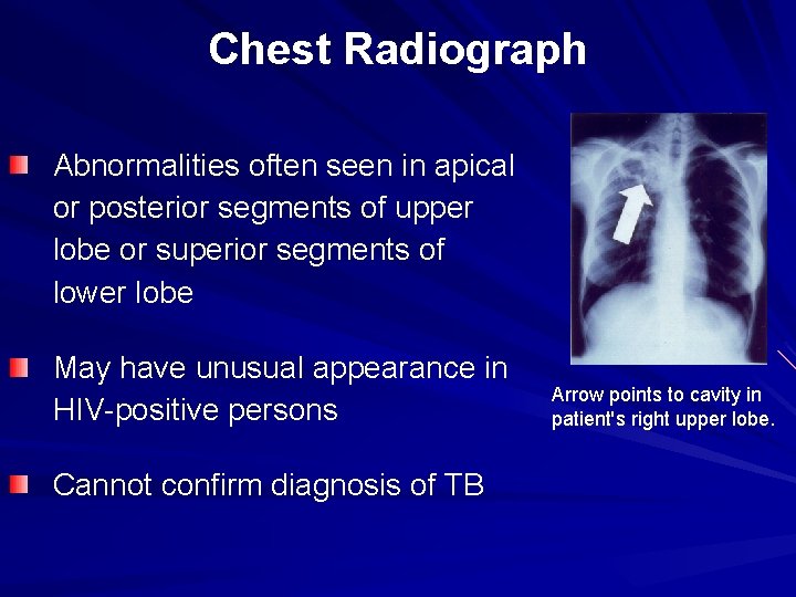 Chest Radiograph Abnormalities often seen in apical or posterior segments of upper lobe or