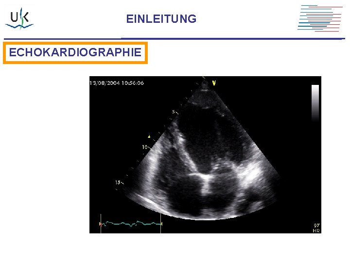 EINLEITUNG ECHOKARDIOGRAPHIE 