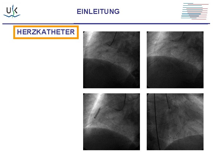 EINLEITUNG HERZKATHETER 