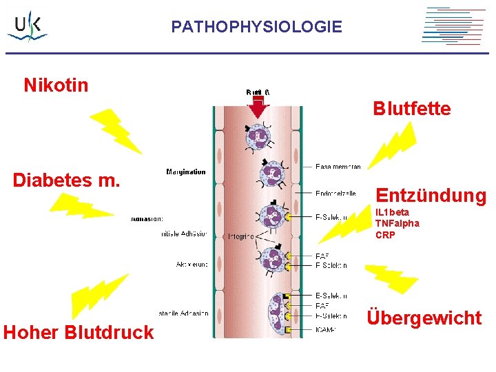 PATHOPHYSIOLOGIE Nikotin Blutfette Diabetes m. Entzündung IL 1 beta TNFalpha CRP Hoher Blutdruck Übergewicht