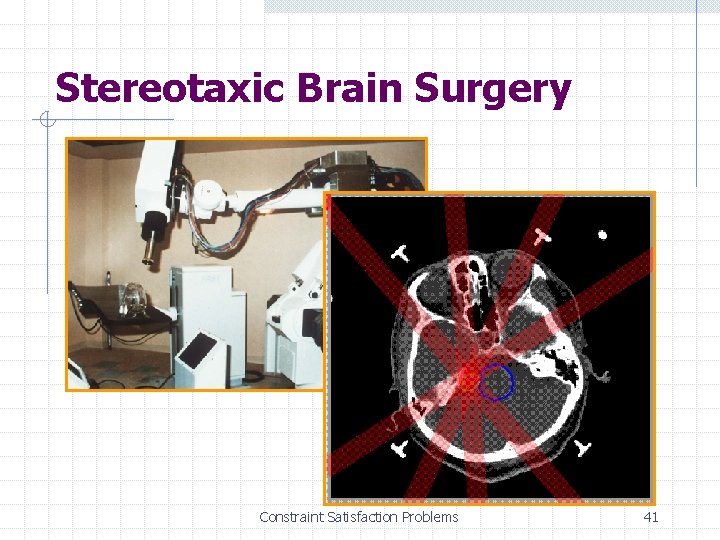 Stereotaxic Brain Surgery Constraint Satisfaction Problems 41 