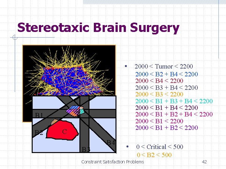 Stereotaxic Brain Surgery 2000 < Tumor < 2200 2000 < B 2 + B