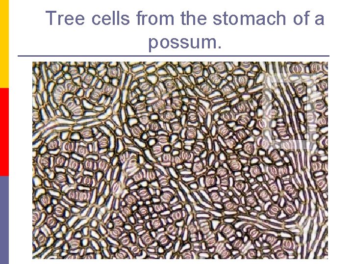 Tree cells from the stomach of a possum. 