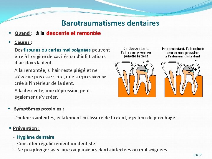 Barotraumatismes dentaires § Quand : à la descente et remontée § Causes : Des