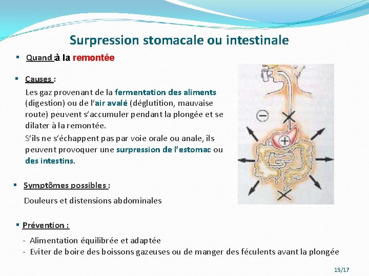 Surpression stomacale ou intestinale § Quand : à la remontée § Causes : Les