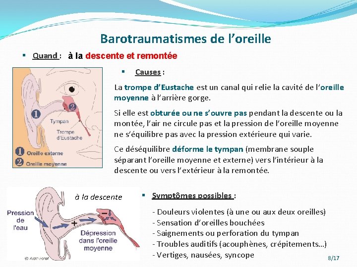 Barotraumatismes de l’oreille § Quand : à la descente et remontée § Causes :