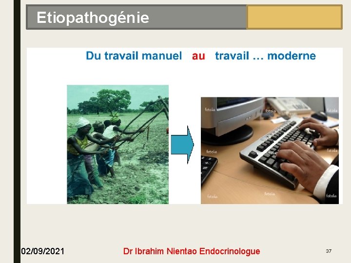 EPIDÉMIOLOGIE Etiopathogénie 02/09/2021 Dr Ibrahim Nientao Endocrinologue 37 