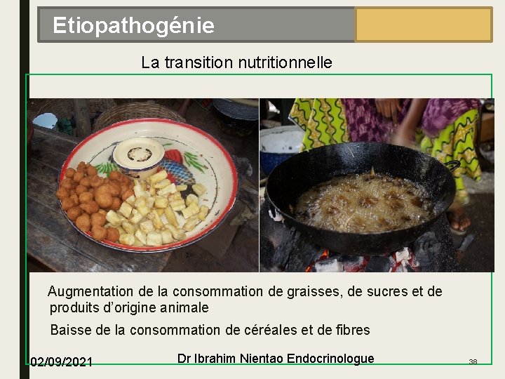 EPIDÉMIOLOGIE Etiopathogénie La transition nutritionnelle Augmentation de la consommation de graisses, de sucres et