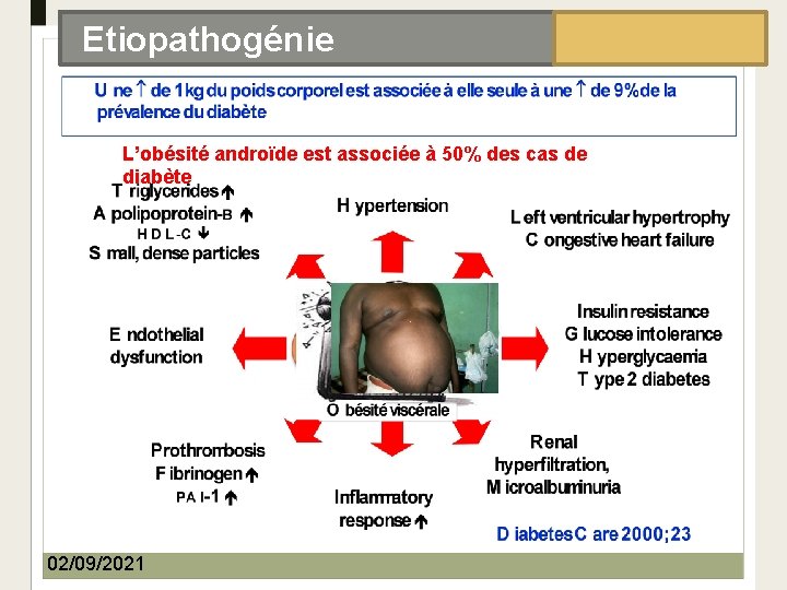 EPIDÉMIOLOGIE Etiopathogénie L’obésité androïde est associée à 50% des cas de diabète 02/09/2021 Dr