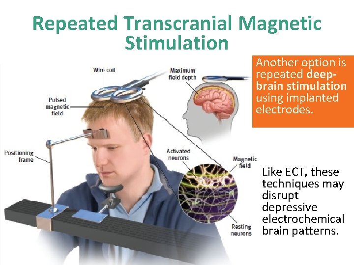 Repeated Transcranial Magnetic Stimulation Another option is repeated deepbrain stimulation using implanted electrodes. Like