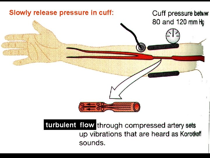 Slowly release pressure in cuff: turbulent flow Slowly release pressure in cuff: turbulent flow