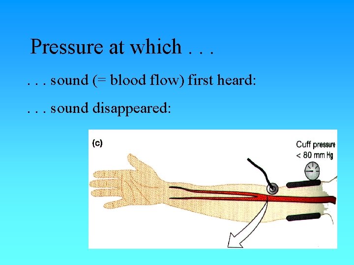 Pressure at which. . . sound (= blood flow) first heard: . . . Pressure at which. . . sound (= blood flow) first heard: . . .