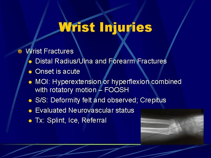 Wrist Injuries Wrist Fractures l Distal Radius/Ulna and Forearm Fractures l Onset is acute