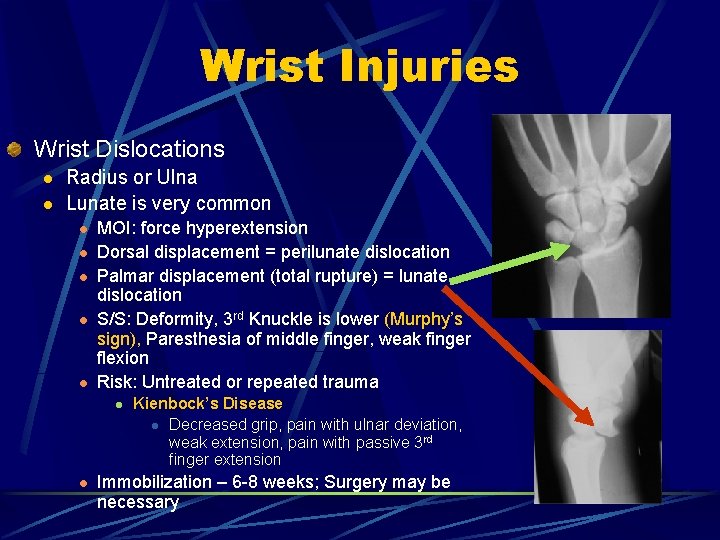 Wrist Injuries Wrist Dislocations l l Radius or Ulna Lunate is very common l