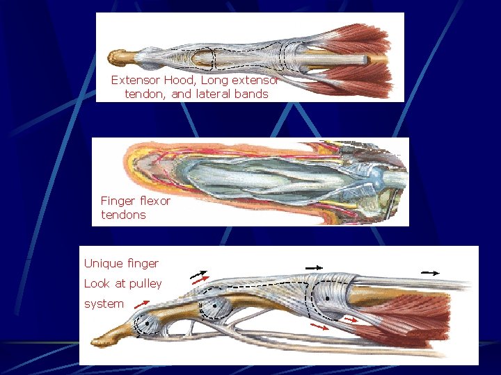 Extensor Hood, Long extensor tendon, and lateral bands Finger flexor tendons Unique finger Look