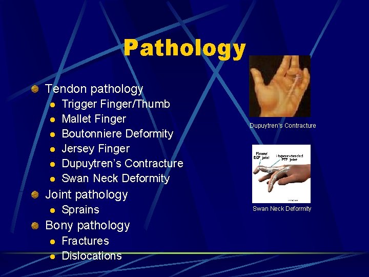 Pathology Tendon pathology l l l Trigger Finger/Thumb Mallet Finger Boutonniere Deformity Jersey Finger