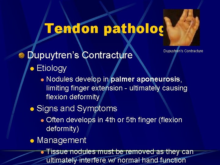 Tendon pathology Dupuytren’s Contracture l Etiology l l Nodules develop in palmer aponeurosis, limiting