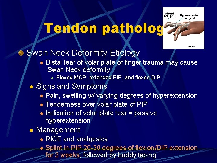 Tendon pathology Swan Neck Deformity Etiology l Distal tear of volar plate or finger