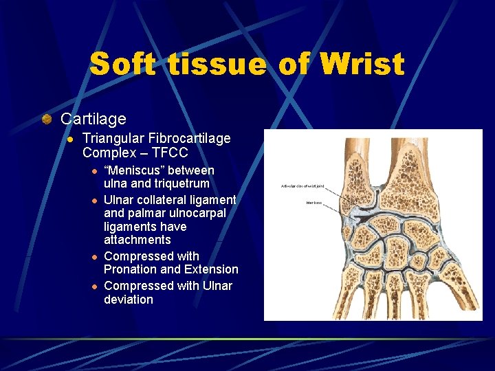 Soft tissue of Wrist Cartilage l Triangular Fibrocartilage Complex – TFCC l l “Meniscus”