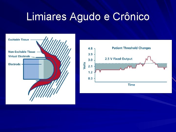 Limiares Agudo e Crônico 