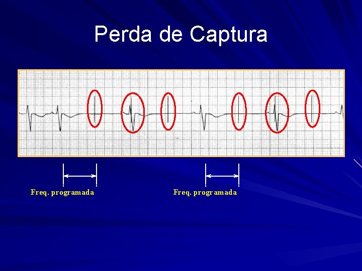 Perda de Captura Freq. programada 