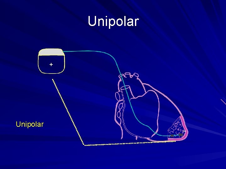 Unipolar + Unipolar _ 