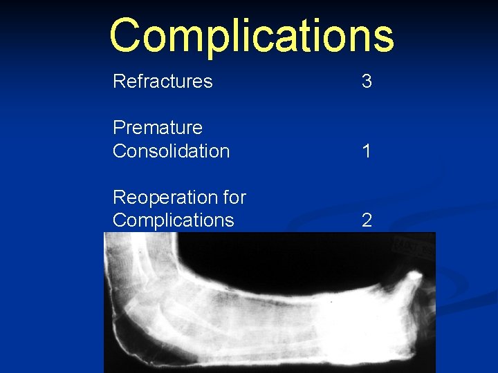 Complications Refractures 3 Premature Consolidation 1 Reoperation for Complications 2 