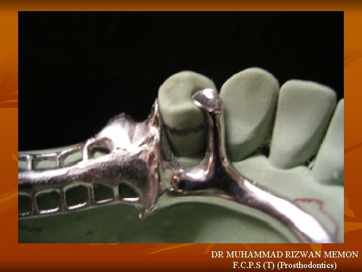 DR MUHAMMAD RIZWAN MEMON F. C. P. S (T) (Prosthodontics) 