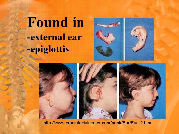 Found in -external ear -epiglottis http: //www. craniofacialcenter. com/book/Ear_2. htm 