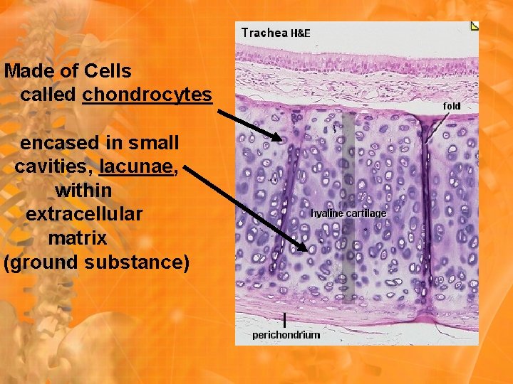 Made of Cells called chondrocytes encased in small cavities, lacunae, within extracellular matrix (ground
